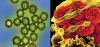 Virus khác gì vi khuẩn? Tại sao kháng sinh không điều trị được bệnh do virus?